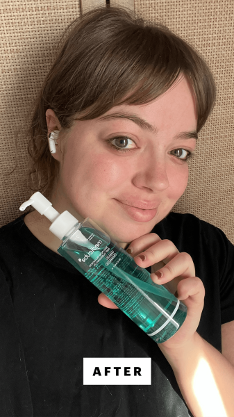 Sarah Hoffmann after using the Medicube Zero Pore Blackhead Deep Cleansing Oil